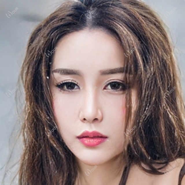 武汉佰视佳眼科项目价目公开 近视手术8000+验光配镜300元起实惠之选