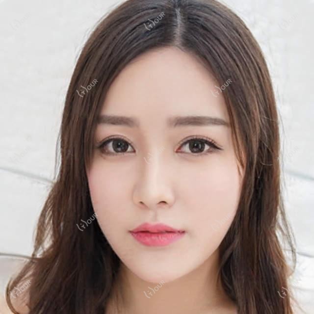 杭州精灵耳手术价格表大公开!附本地靠谱医院推荐清单