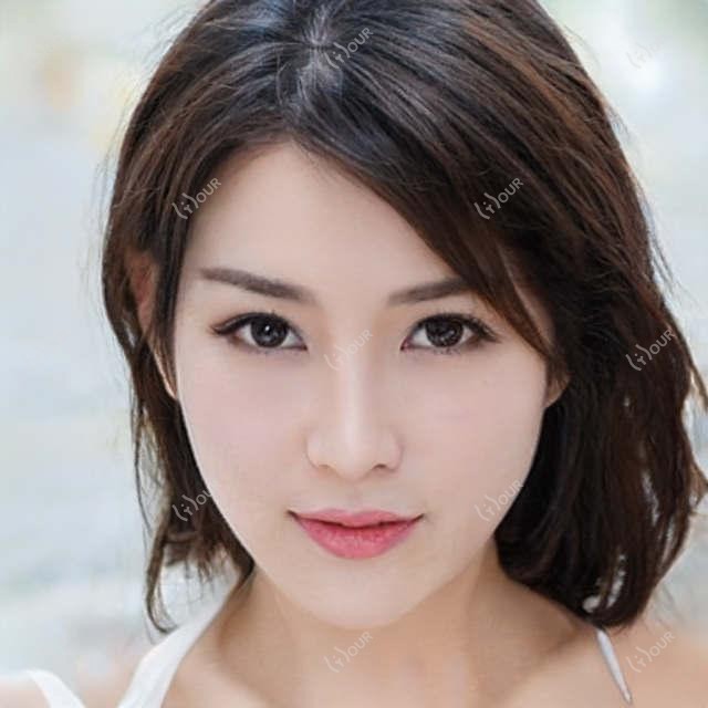 长沙美版术后肿胀正常吗 价格与消肿护理全解析