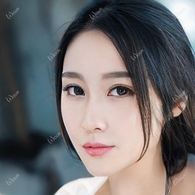 常州眼科医生推荐:白内障近视手术高手云集!刘瑶、陈兵、蔡磊琳技术精细,口碑优良!