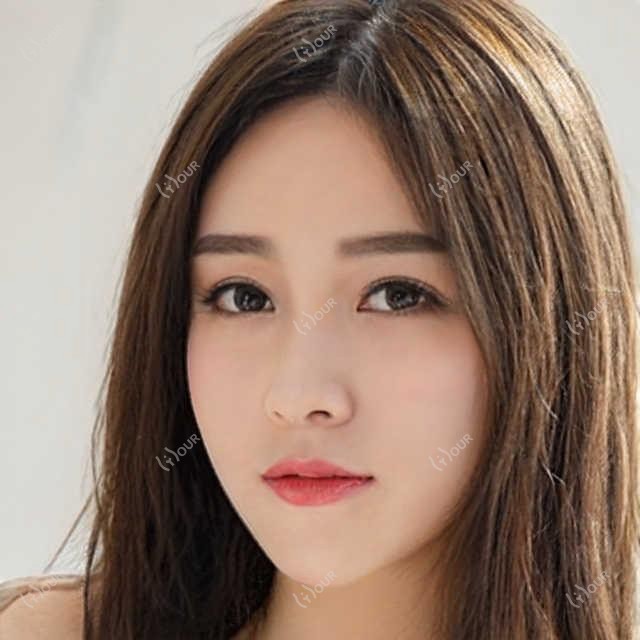 重庆价目表2025:德国鹰视EX500全激光价格14969元,睛逸C+全激光手术1.9w元起