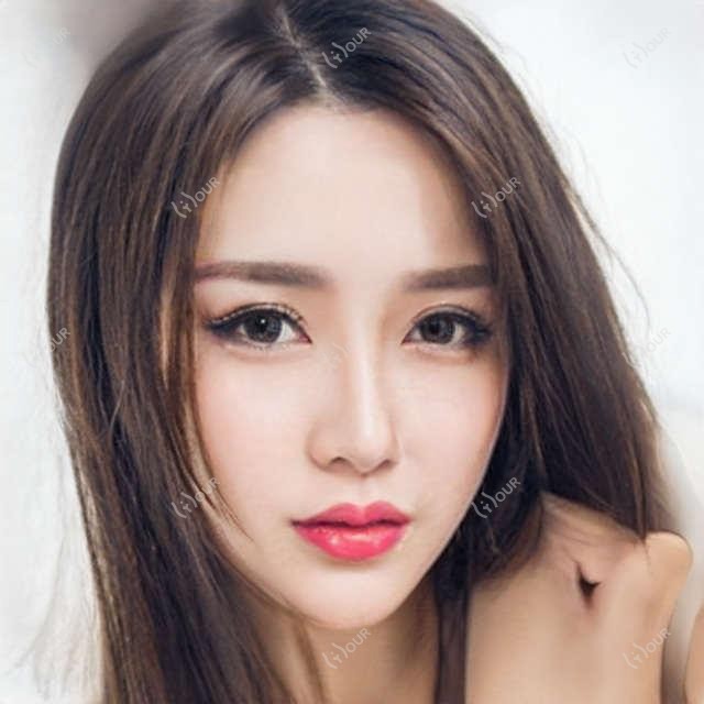 淄博地区鼻整形名家评测:于洪亮、蒋学金、杨辉,精细技艺打造自然美鼻