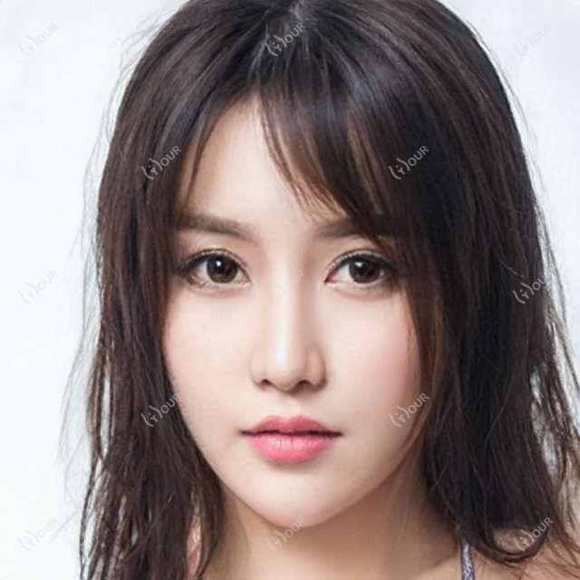 黄金软膜填充卧蚕在常州疗效如何 价格与术后护理全解析