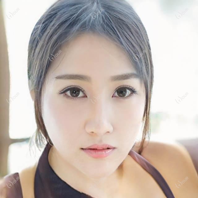 济宁京合眼科全项目价格表：近视眼手术、眼袋去除至脂肪填充详列