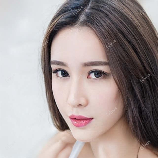 上海新视界眼科全项目价格揭晓：激光近视9K+至晶体植入3W+一览