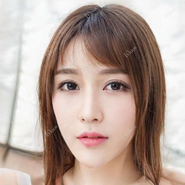 上海医大眼科全项目价格揭秘:近视激光、白内障手术等热门医美一览