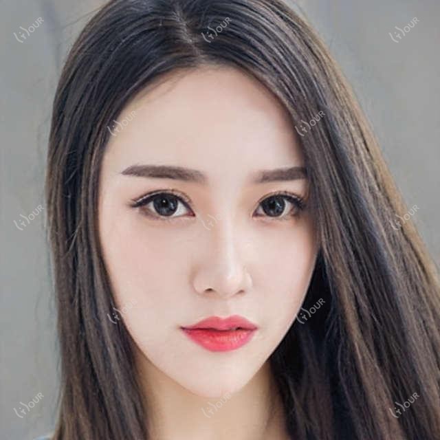 廊坊牙齿矫正医生推荐:李游、吴虎、吴杰隐形矫正与美容修复技术精细