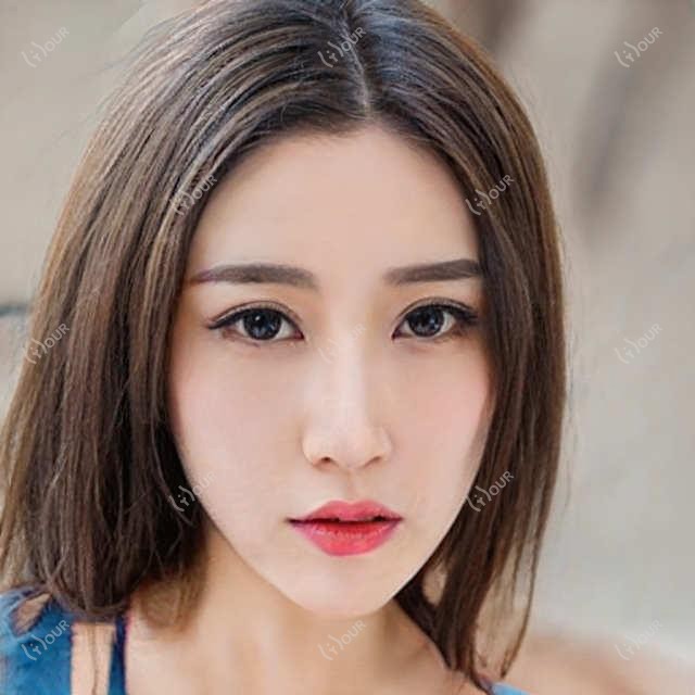 东莞光子嫩肤多少钱？2024较新价目表+5家靠谱医院真实测评