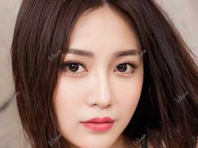 南京濡白天使丰下巴价格对比 医院与医美机构排名解析