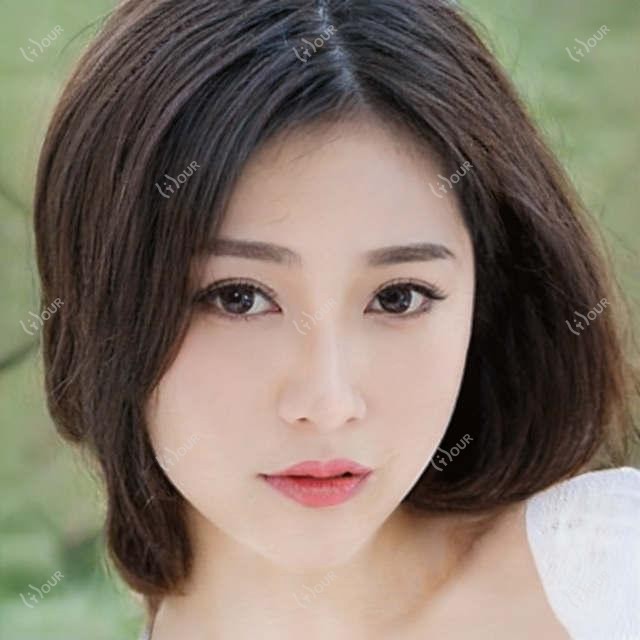 芜湖擅长眼科手术医生推荐:金伟王俊芳精通近视白内障矫正