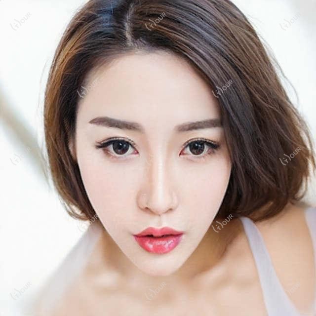 成都何视佳眼科全项目价格揭秘:近视激光、白内障手术等热门医美项目费用一览