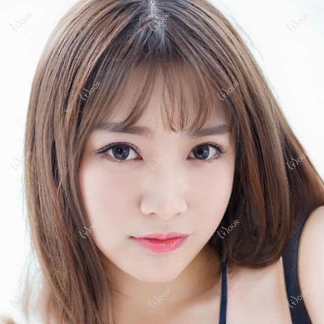 南京丰额头手术价格多少?这家南京口碑机构值得推荐:艺星医疗美容!