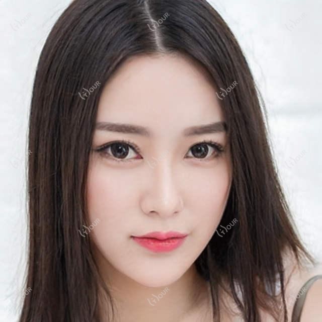 南通美拉美全脸价格解析 多少钱做一次疗效更好
