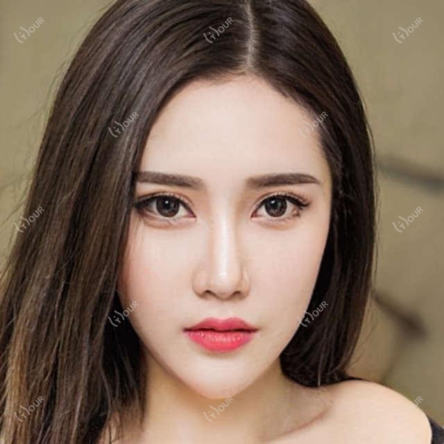 深圳卫尔斯眼科价格表出炉:近视手术6800+干眼治疗980+验光配镜300元起实惠优选