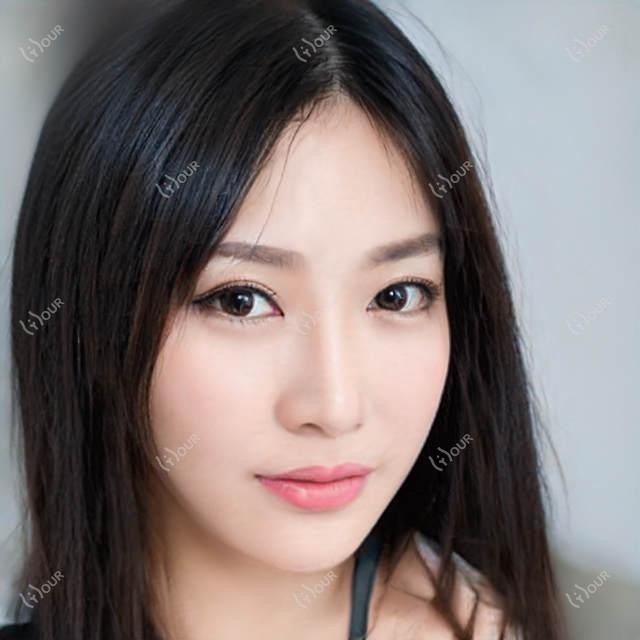 东营M唇整形价格大公开！3k-8k的价位点这里看明细！