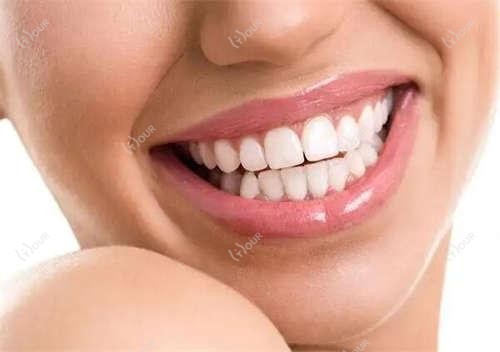 除皱抗衰|扬州Inmode热提拉限时体验价3980!疗效惊艳必须冲!