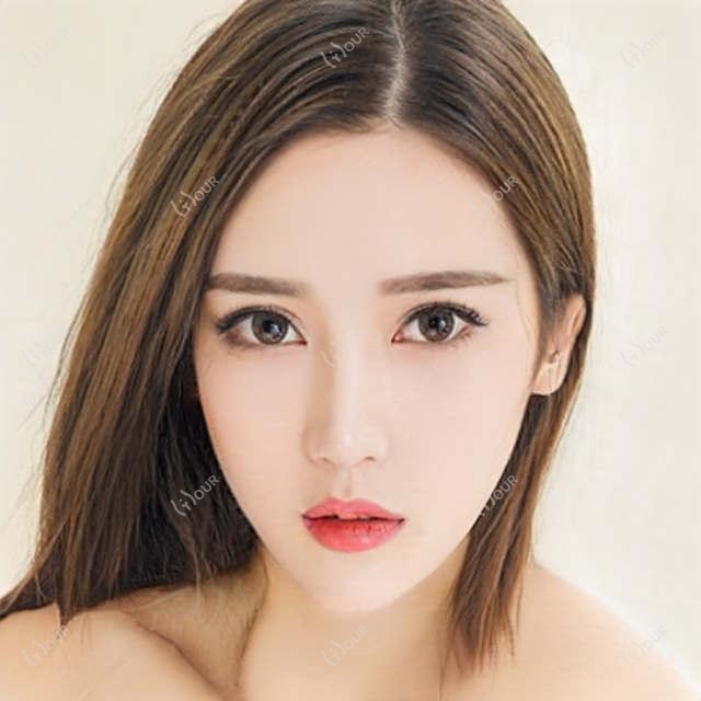 江门近视手术医生赵春阳推荐榜(含特色项目+费用解析)_爱尔眼科必看