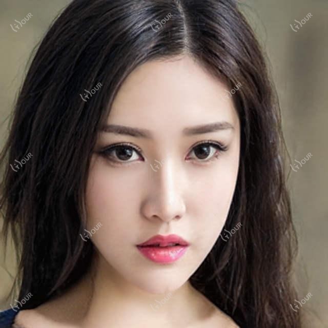 聊城高颅顶手术价格多少?这家聊城口碑机构值得推荐:聊城伊美尔医疗美容!