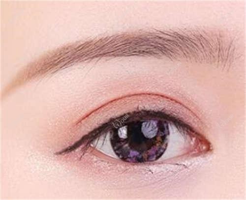 天津M唇3D塑形和微笑唇怎么选?6880元和9800元项目对比指南