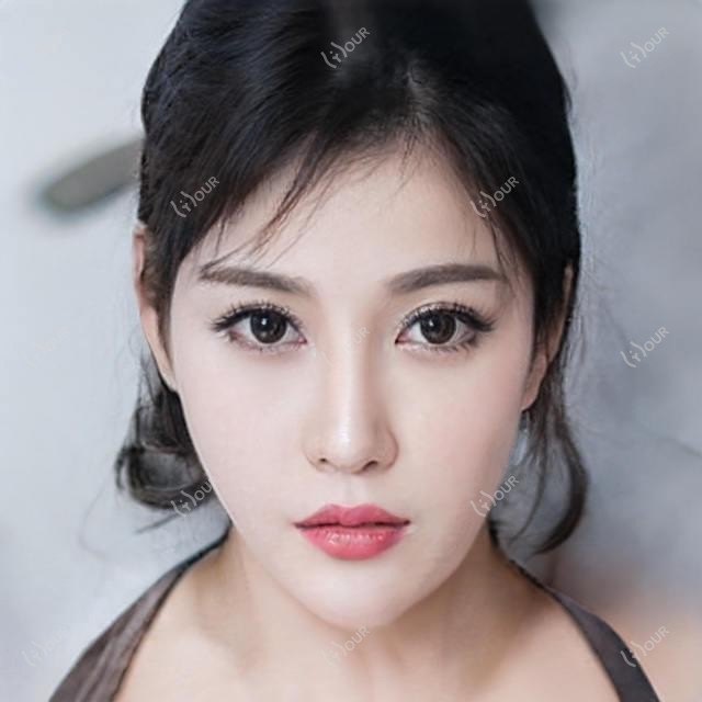 安阳光子嫩肤多少钱一次？光子嫩肤价格800~3000元起疗效能维持多久？