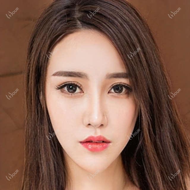 郑州近视手术医生推荐:万光明、庞辰久、王卫群,眼科治疗经验比较丰富