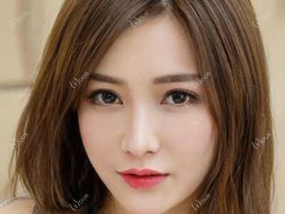 衡阳m22光子嫩肤和黄金微针先做哪个?m22全模式价格1980起疗效能维持多久?