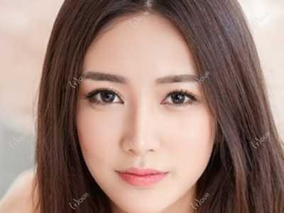 深圳面部抗衰医生哪家强 华美价格与疗效排名解析