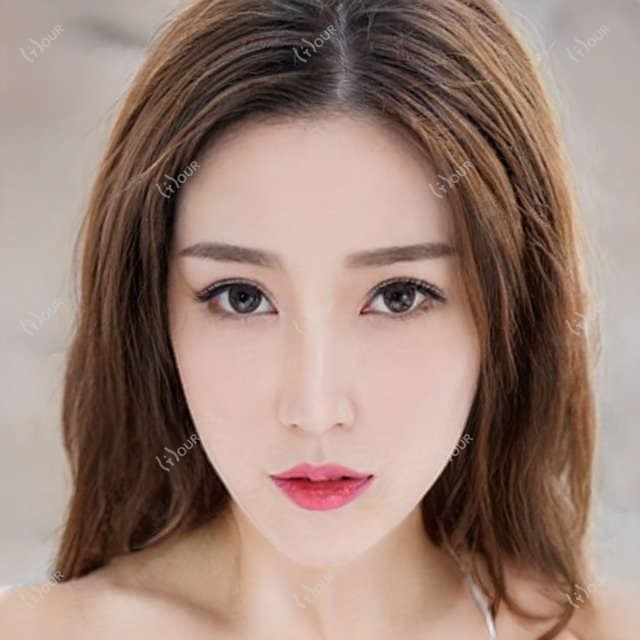 肇庆做直角肩手术多少钱 价格与排名深度解析