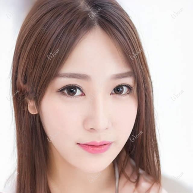 东莞肉欲唇价格表公开!附本地靠谱医院推荐清单