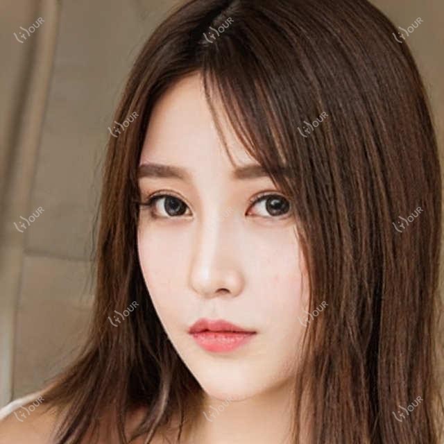 呼和浩特微笑唇手术前后对比照价格与疗效排名分析