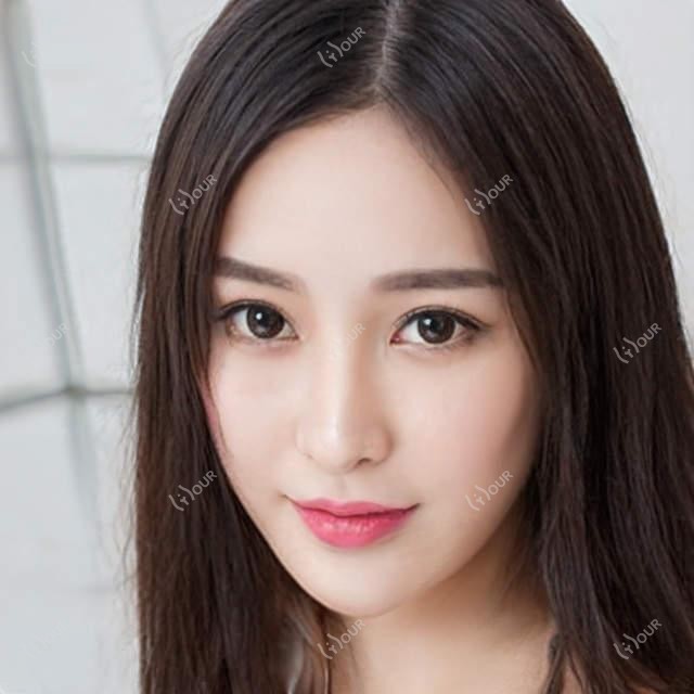 西安丰下巴国产玻尿酸品牌价格对比，性价比排名一目了然